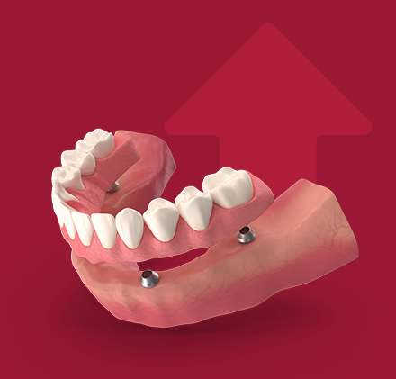 Cicatrização óssea acelerada 
