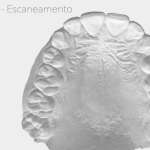 munerato-006
