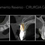 munerato-007