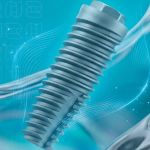 Desempenho clínico e simplicidade: a nova linha de implantes Lite da S.I.N. em casos de implantes de carga imediata