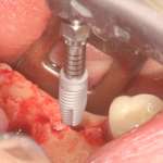 imagem17-4