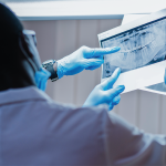 Passo a passo para planejar seu primeiro caso clínico odontológico de implante