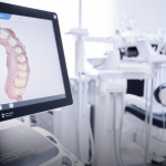 Escaneamento intraoral: o equipamento que muda a experiência do Paciente