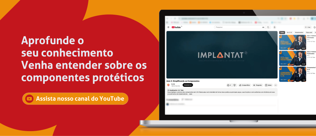 Aprofunde o seu conhecimento
Venha entender sobre os componentes protéticos