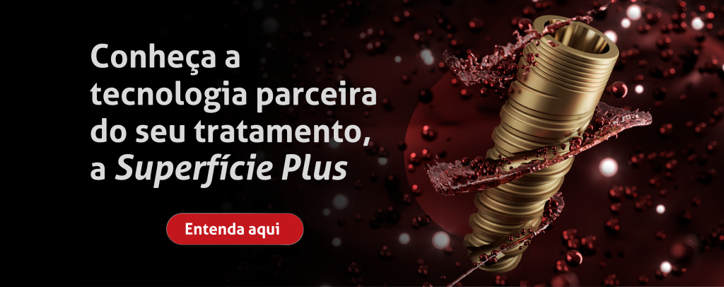 Conheça a tecnologia parceira do seu tratamento, a Superfície Plus