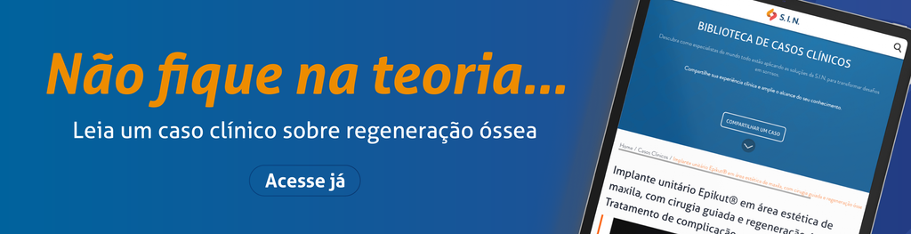 Não fique na teoria…
Leia um caso clínico sobre regeneração óssea
CTA: Acesse já