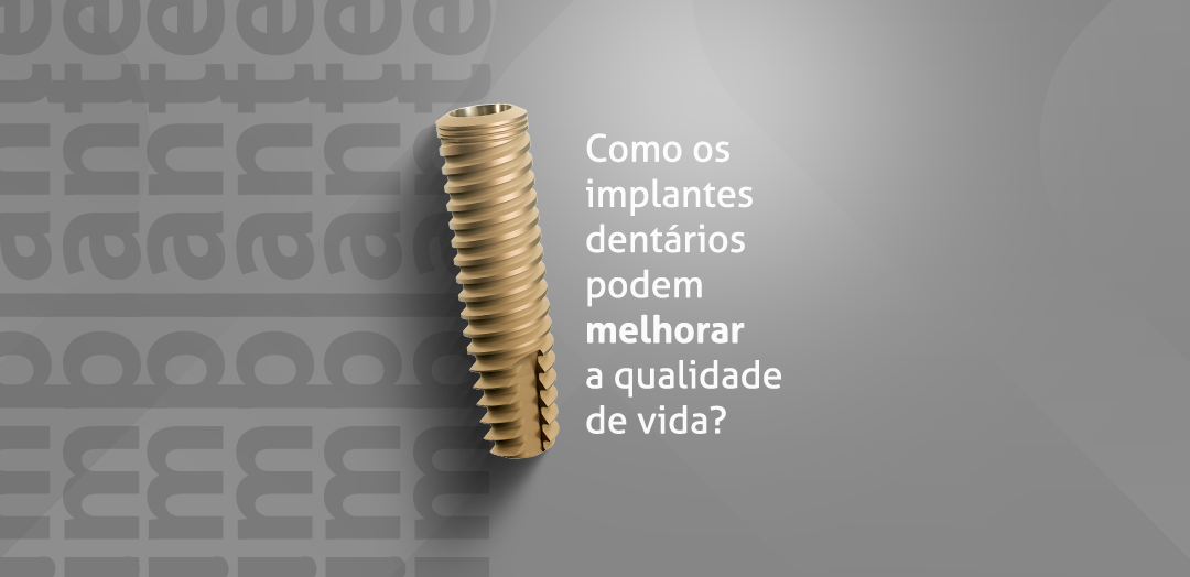 Como os implantes dentários podem melhorar a qualidade de vida? 