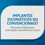 Guia Completo: Implantes Zigomáticos ou Convencionais?
